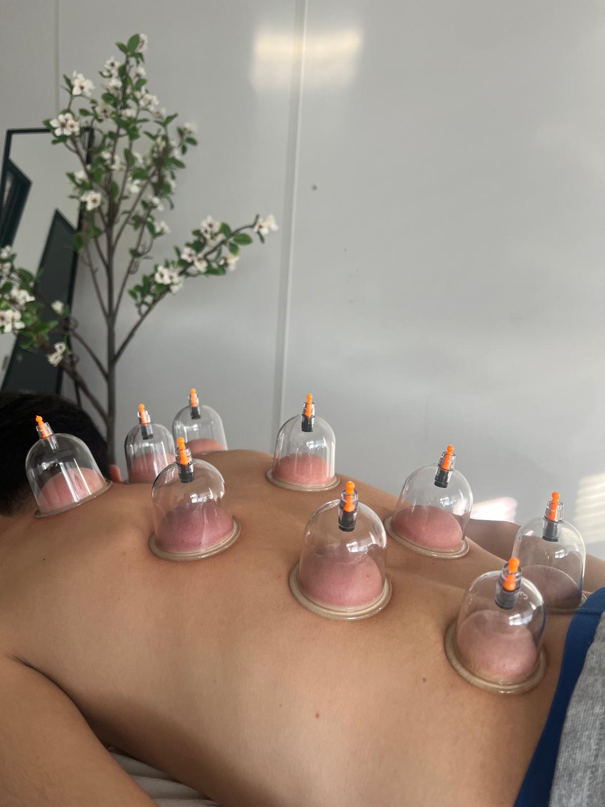 Dry Cupping